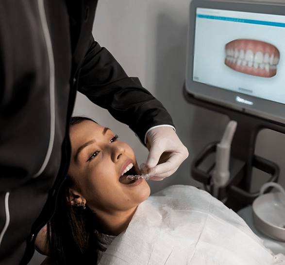 Dental Sealant