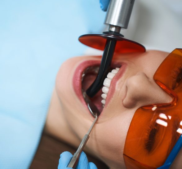 Patient receiving dental treatment with a UV light tool. Wearing protective orange goggles, a dentist uses a tool to examine her teeth, creating a clinical tone.